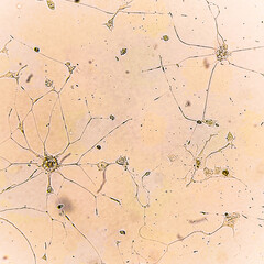 Human glioma cells.