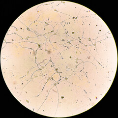 Human glioma cells.
