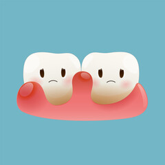 illustrstion of gum disease. Periodontal disease. Periodontitis disease. Vector and Cartoon