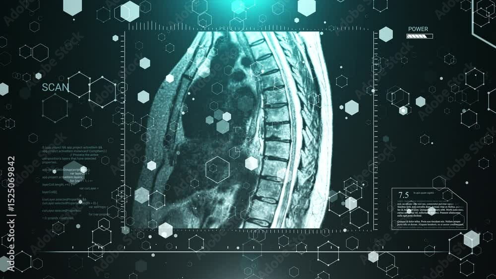 Poster medical scan of spine with futuristic interface and data overlay video