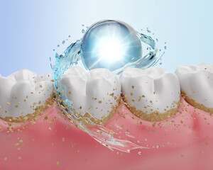 Close-up of a dental cleaning showing the removal of plaque at the gum line, This image highlights the process of removing plaque and food particles. 3d rendering.