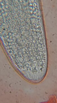 time laps footage of super magnification of demodex face mite showing internal structures under the microscope