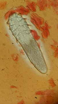 time laps footage of super magnification of demodex face mite showing internal structures under the microscope