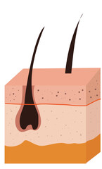  hair losing with scalp layer vector