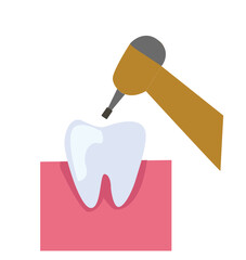tartar treatment.Teeth undergoing plaque removal and scaling