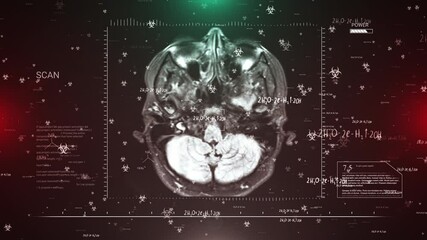 Medical Brain Scan with Biohazard Symbols and Scientific Data Overlay - Powered by Adobe