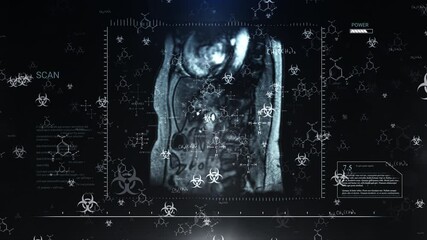 Medical Scan with Biohazard Symbols and Chemical Structures Overlayed on Dark Background - Powered by Adobe