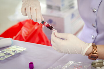 Nurse wearing white medical gloves is drawing blood from patient's arm for examination or PRP procedure. Concept of laboratory research, medicine, analysis.