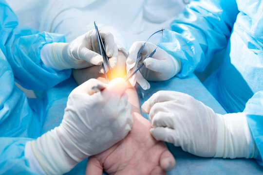 Surgeons Performing Delicate Wrist Surgery Using Advanced Medical Tools in a Sterile Operating Room, top view