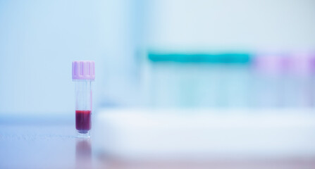 Plakat Blood sample of dog in test tube in veterinary clinic laboratory setting before operation