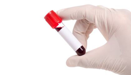 A gloved hand holding a blood vial, capturing a moment of medical examination and scientific analysis. The sample vial, filled with a deep red fluid, suggests healthcare, research.