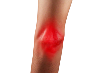 Inflamed elbow (Turns slightly red). isolated on transparent or white background