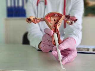 Doctor shows uterine models vaginal suppositories. Gynecologist shows treatment of delayed...