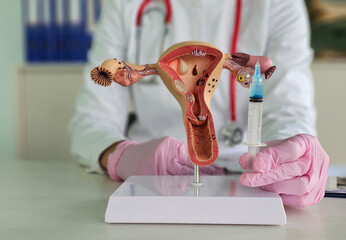 Injection into a medical mockup of the female reproductive system on a blue background. The of...