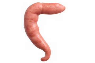 Realistic 3d rendering of an inflamed appendix isolated on transparent background, perfect for medical illustrations and educational materials