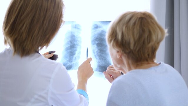 Doctor pointing at radiography while explaining diagnosis to patient during medical consultation in a bright clinic, emphasizing healthcare and the importance of clear communication in treatment