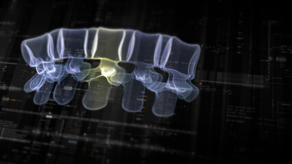 Futuristic biomedical concept with advanced holographic scanning and HUD diagnosing spinal disc herniation using 3D holograms of a patient’s backbone, AR, and real-time medical imaging