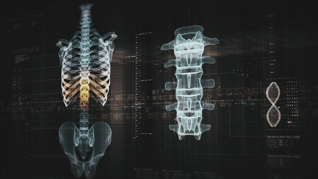 Futuristic biomedical concept with advanced holographic scanning and HUD diagnosing spinal disc herniation using 3D holograms of a patient’s backbone, AR, and real-time medical imaging