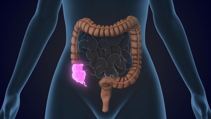 The Cecum is a section of the large intestine
