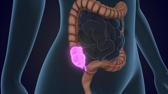 The Cecum is a section of the large intestine