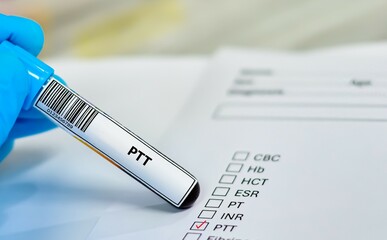 Blood sample tube and paper order request for PTT.
