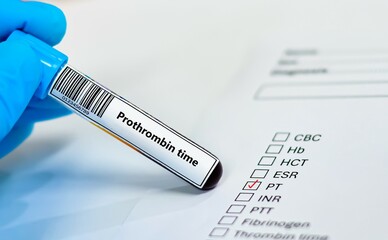 Obraz premium Blood sample tube and paper order request for prothrombin time.