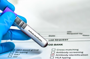 Blood sample tube and paper order request for antibody identification test analysis.