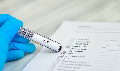 Blood sample tube and paper order request for ATK test analysis.