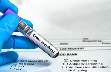 Blood sample tube and paper order request for cross matching test analysis.