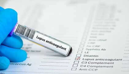 Blood sample tube and paper order request for lupus anticoagulant.