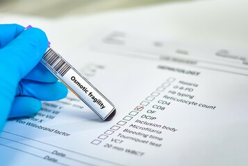 Blood sample tube and paper order request for osmotic fragility test analysis.