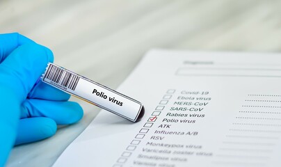 Naklejka premium Blood sample tube and paper order request for polio virus.