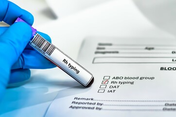 Blood sample tube and paper order request for Rh typing.