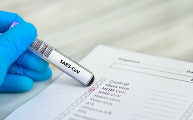 Blood sample tube and paper order request for SARS-CoV.