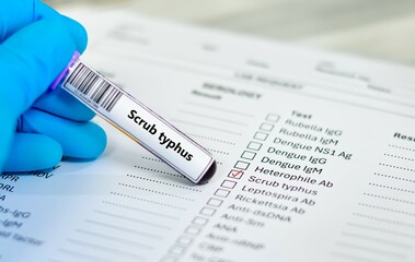 Blood sample tube and paper order request for scrub typhus test analysis.