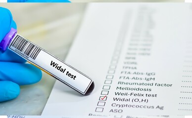 Blood sample tube and paper order request for widal test analysis.