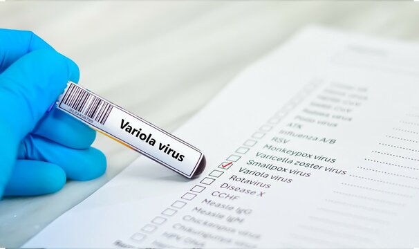 Blood sample tube and paper order request for variola virus test analysis.