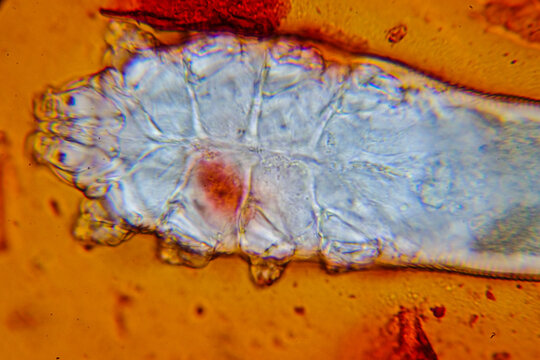 demodex face maite stained with safranin under the microscope
