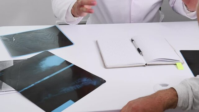 Doctor examines patient wrist and palm palpation. wrist mobility test, orthopedic (or neurological) provocation tests to diagnose hand, wrist and nerve disorders. Phalen's Finkelstein's test, Tinel'