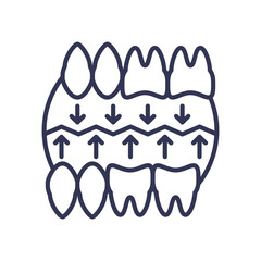 Illustration of teeth alignment with arrows indicating guided movement.
