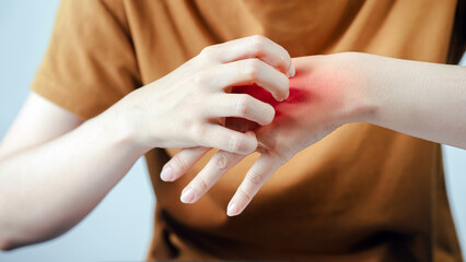 Person scratching irritated skin on hand, showing redness and discomfort, possibly due to allergy, eczema, or insect bite, highlighting health and dermatology concern