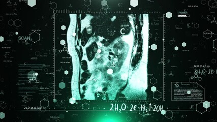 Medical Scan Analysis: Molecular Structure Overlay on MRI - Powered by Adobe