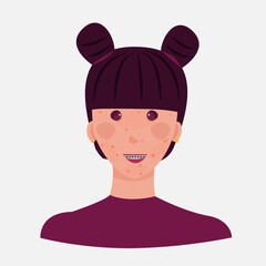 Teen girl avatar with acne and pimples smiling. The girl has dark hair and braces. Universal image. Vector graphics.