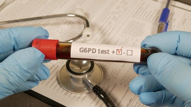 Doctor showing positive g6pd test result