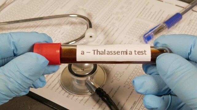 Doctor showing alpha thalassemia blood test tube