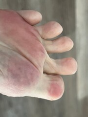 Closeup of playful toes with pink pads