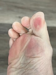 Closeup of playful toes with pink pads