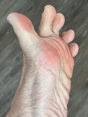 Closeup of playful toes with pink pads