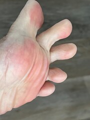 Closeup of playful toes with pink pads
