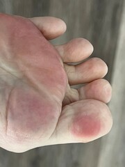 Closeup of playful toes with pink pads